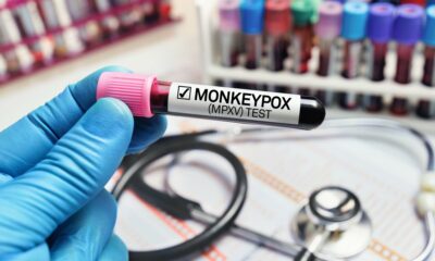 Où en est l'épidémie de variole du singe en Europe ?
